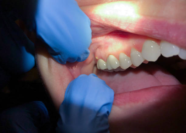 Stoneville, NC Emergency Dentist Pros