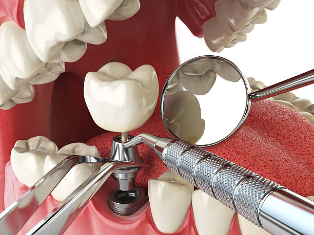 Best 24-Hour Emergency Dentist in Stoneville, NC